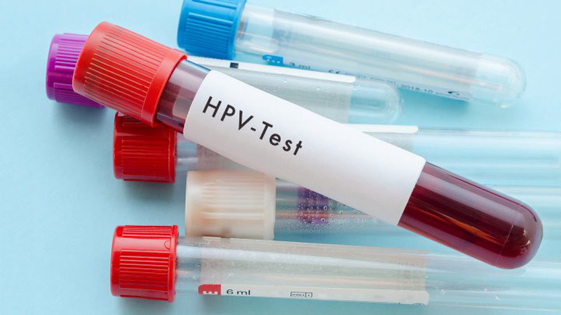 ảnh xét nghiệm HPV