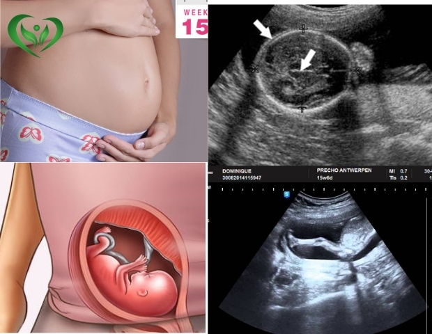 Hình ảnh siêu âm thai lúc 15 tuần