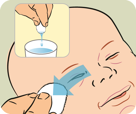 cách test Chlamydia mắt trẻ sơ sinh