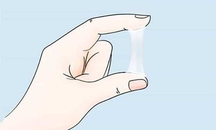 Tăng tiết chất nhầy âm đạo