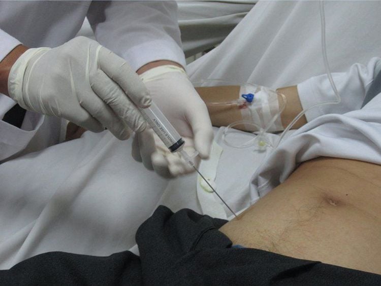 Chăm sóc cần thận sau khi chọc dịch màng bụng 
