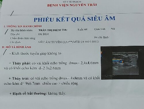 Hiểu Biết và Quản Lý Bệnh Án U Lành Tuyến Giáp: Hành Trang Cho Sức Khỏe cập nhật mới nhất 2025