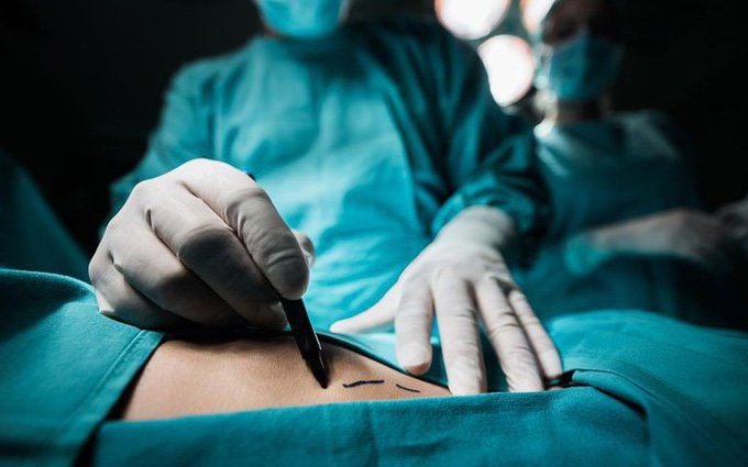 chi phí mổ u tuyến giáp bệnh viện K