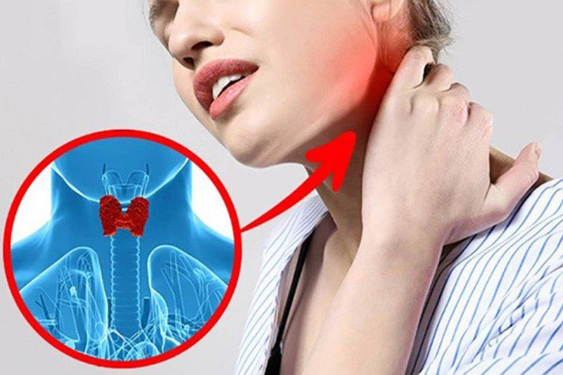 Khám U Tuyến Giáp Ở Hà Nội